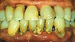 Click image for larger version

Name:	teeth.jpg
Views:	94
Size:	24.8 KB
ID:	7108